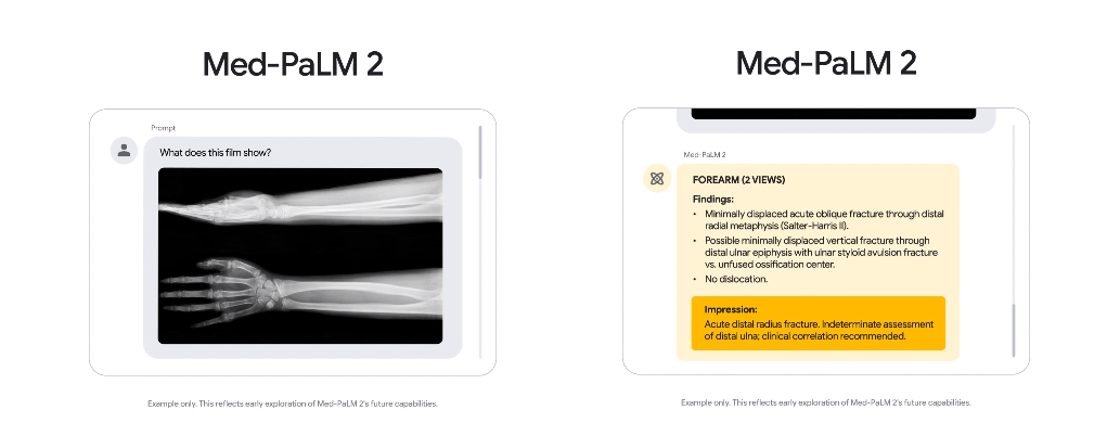 I medici del Mayo trovano lacune ma anche promesse nel modello di IA medica di Google Med-PaLM 2