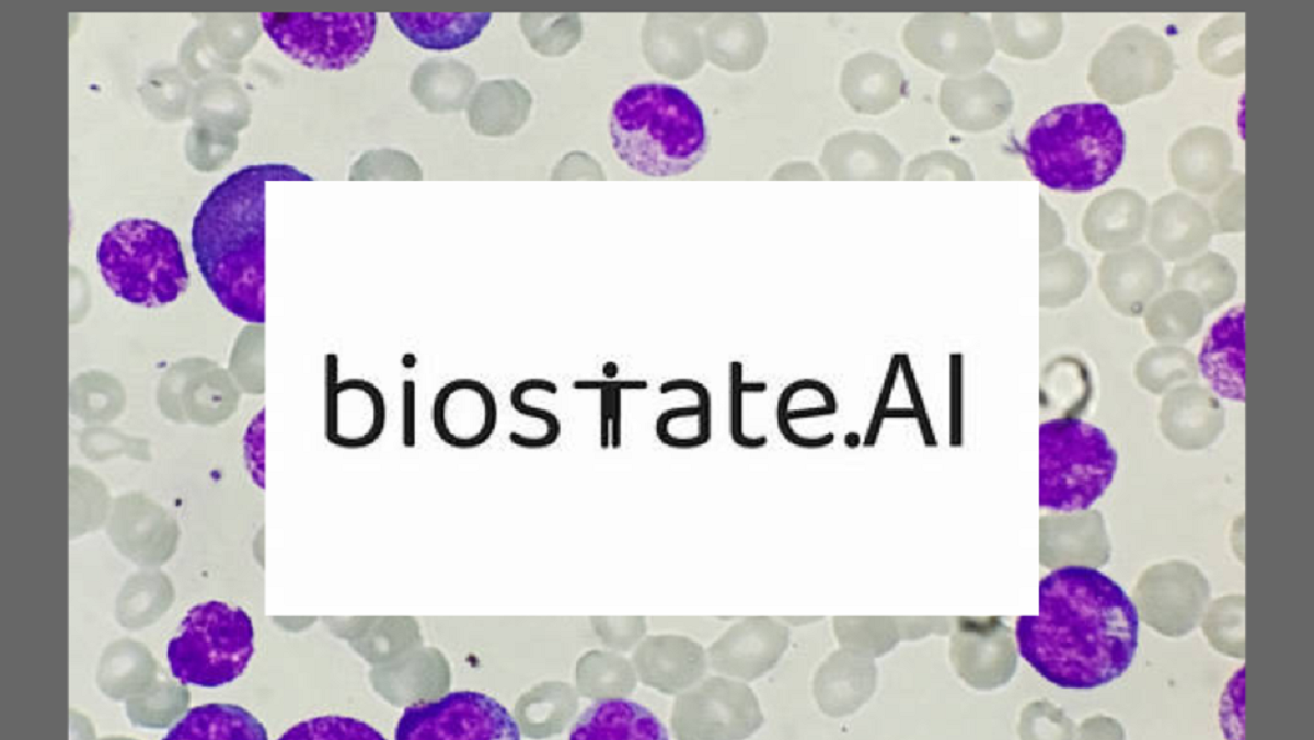 AI e RNA-seq per la cura personalizzata della leucemia