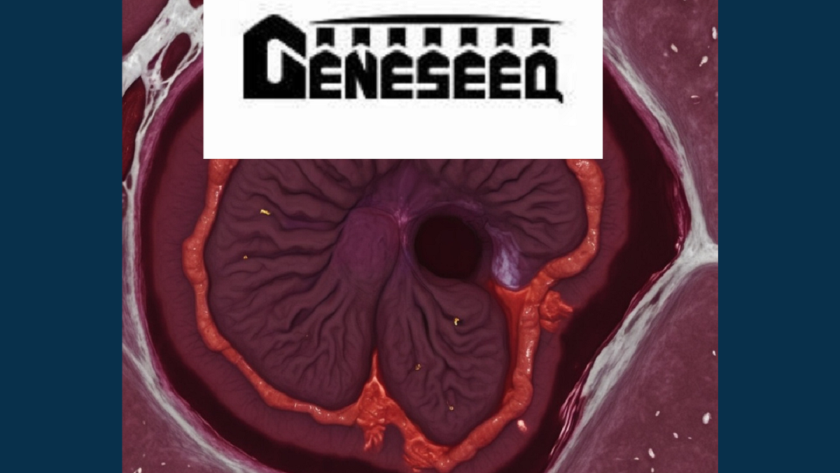 Nuovo test del sangue Geneseeq per il pancreas: diagnosi precoce più vicina