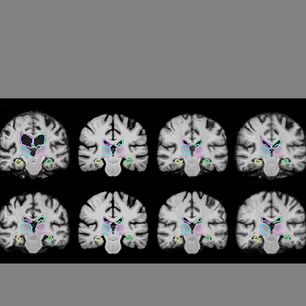 Un nuovo modello AI per l’analisi delle scansioni mediche
