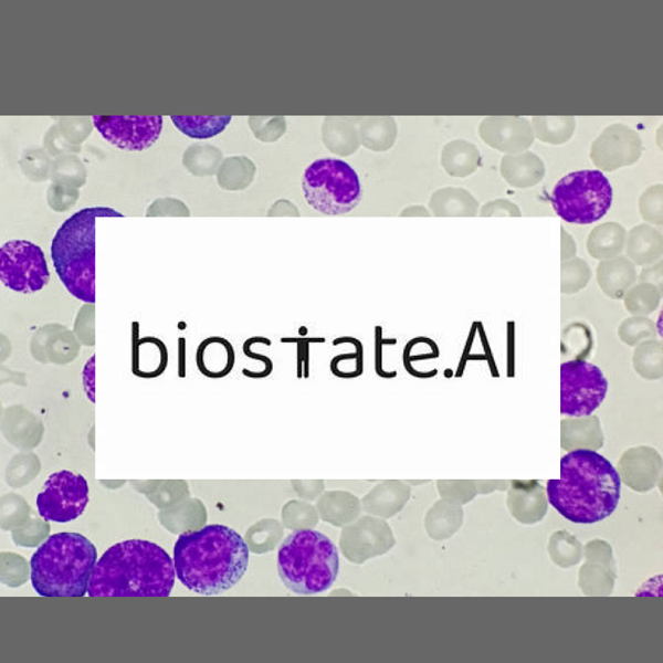 AI e RNA-seq per la cura personalizzata della leucemia