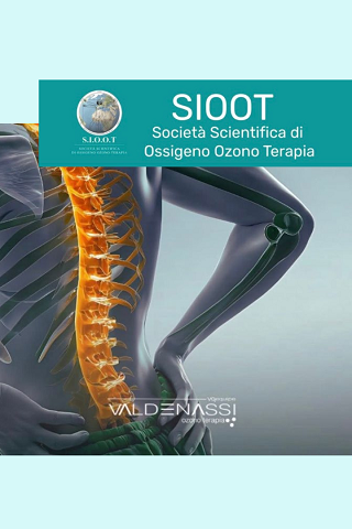 Ossigeno Ozono Terapia: un’alleata contro il mal di schiena